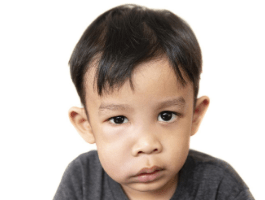 Child facial swelling teeth